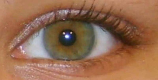 Yeşil gözler